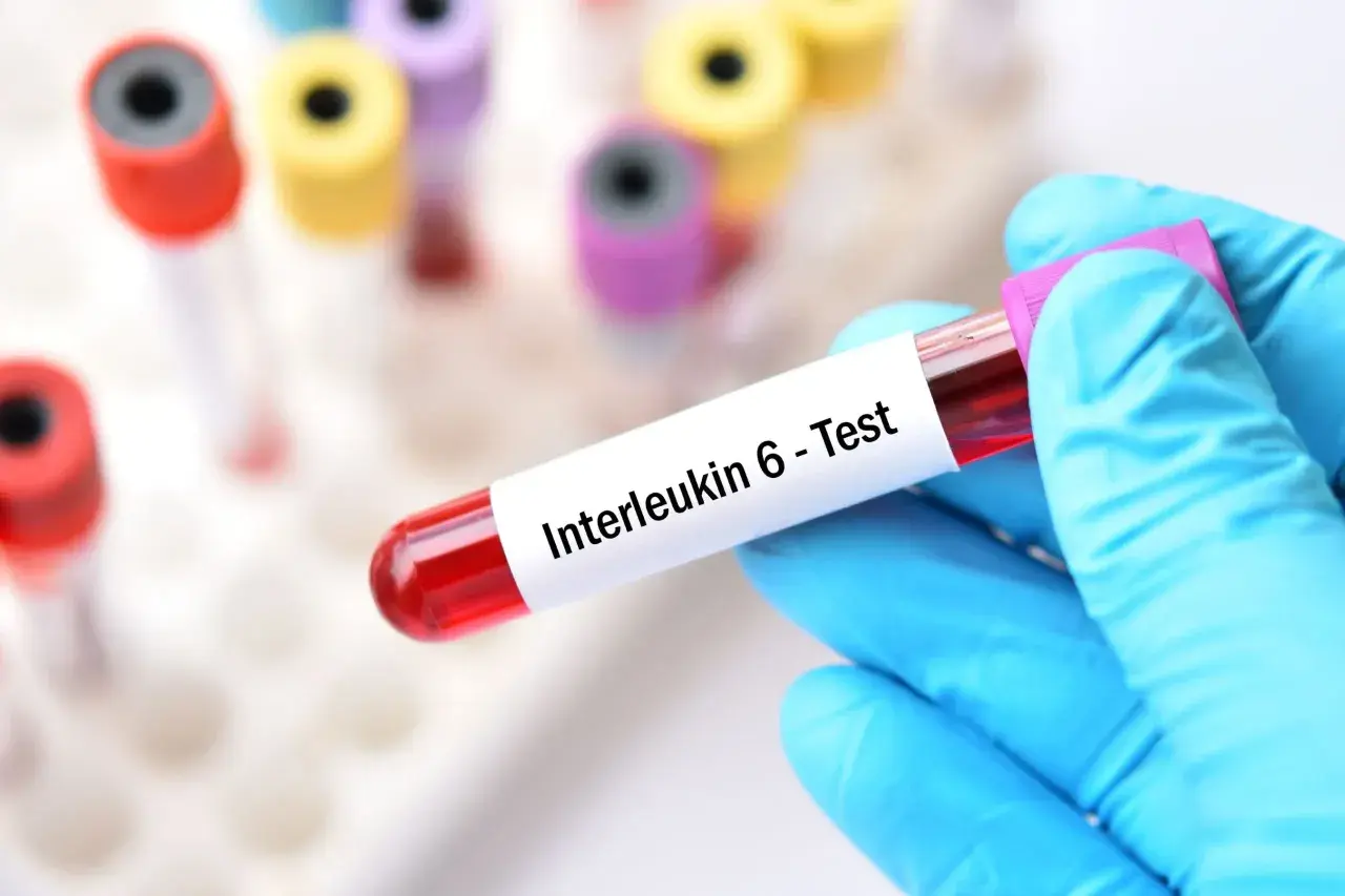 Ręka w niebieskiej rękawiczce trzyma probówkę z krwią do testu na interleukinę 6. Cytokiny co to? To białka sygnałowe układu odpornościowego.