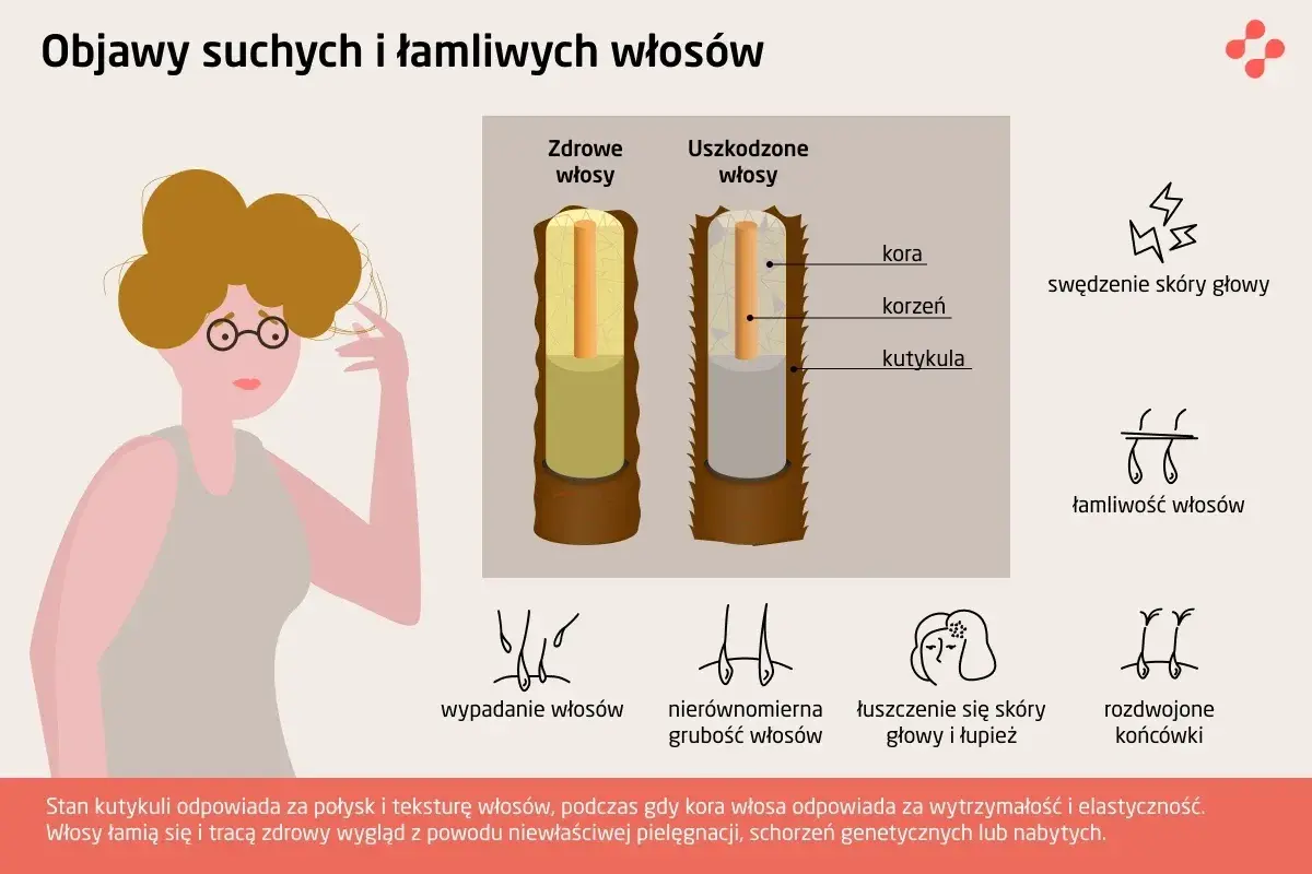 Ilustracja pokazuje porównanie zdrowych i uszkodzonych włosów, podkreślając problem łamliwości.