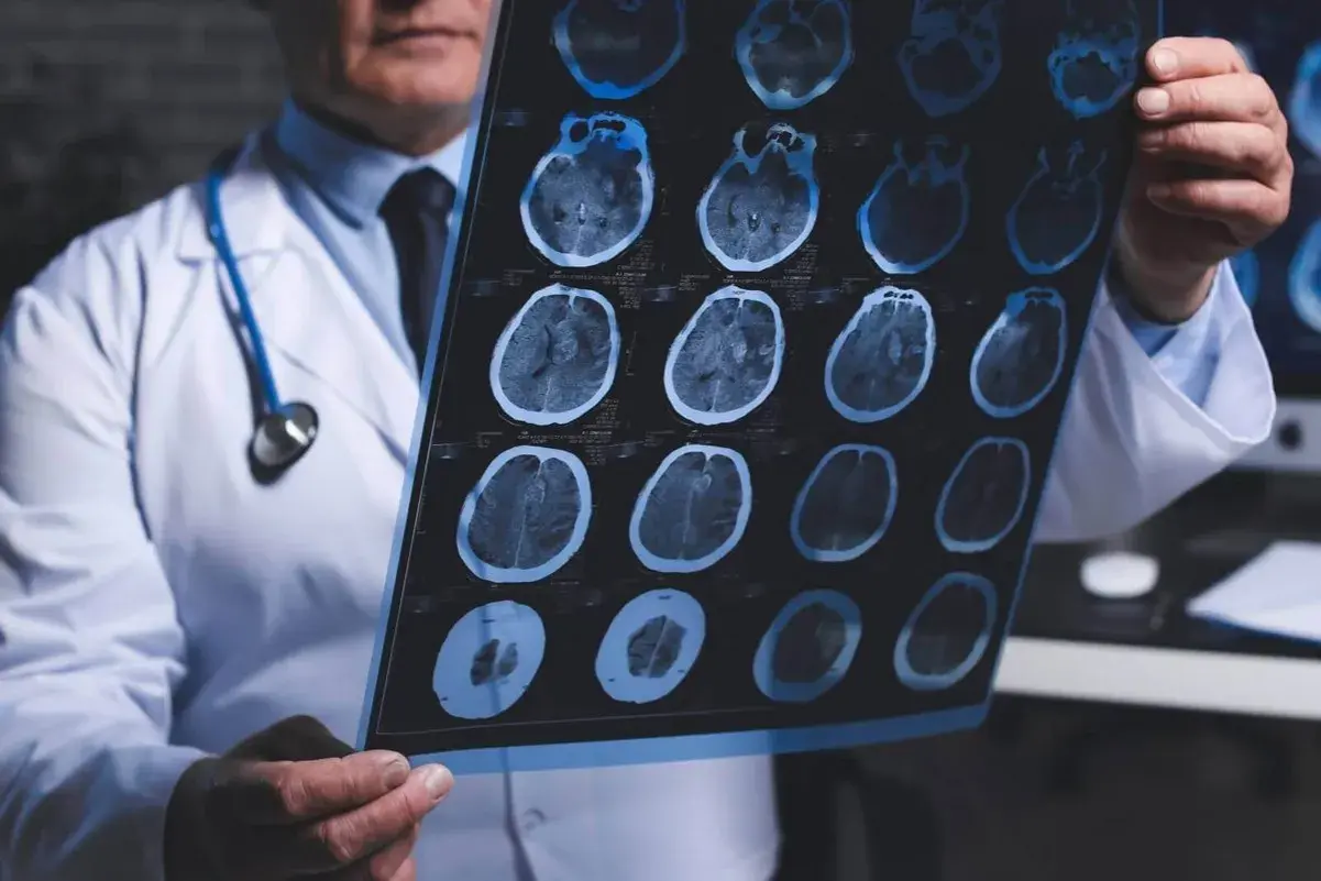 Neurolog od czego zacząć? Objawy, które mogą zaskoczyć