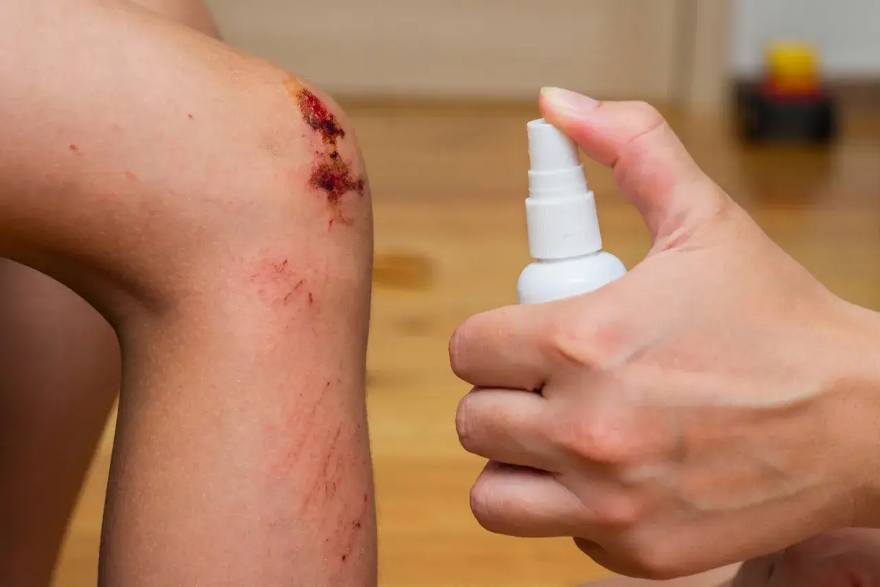 Application d'un spray désinfectant sur un genou écorché, pas de point de suture ni de pansement pour l'instant.