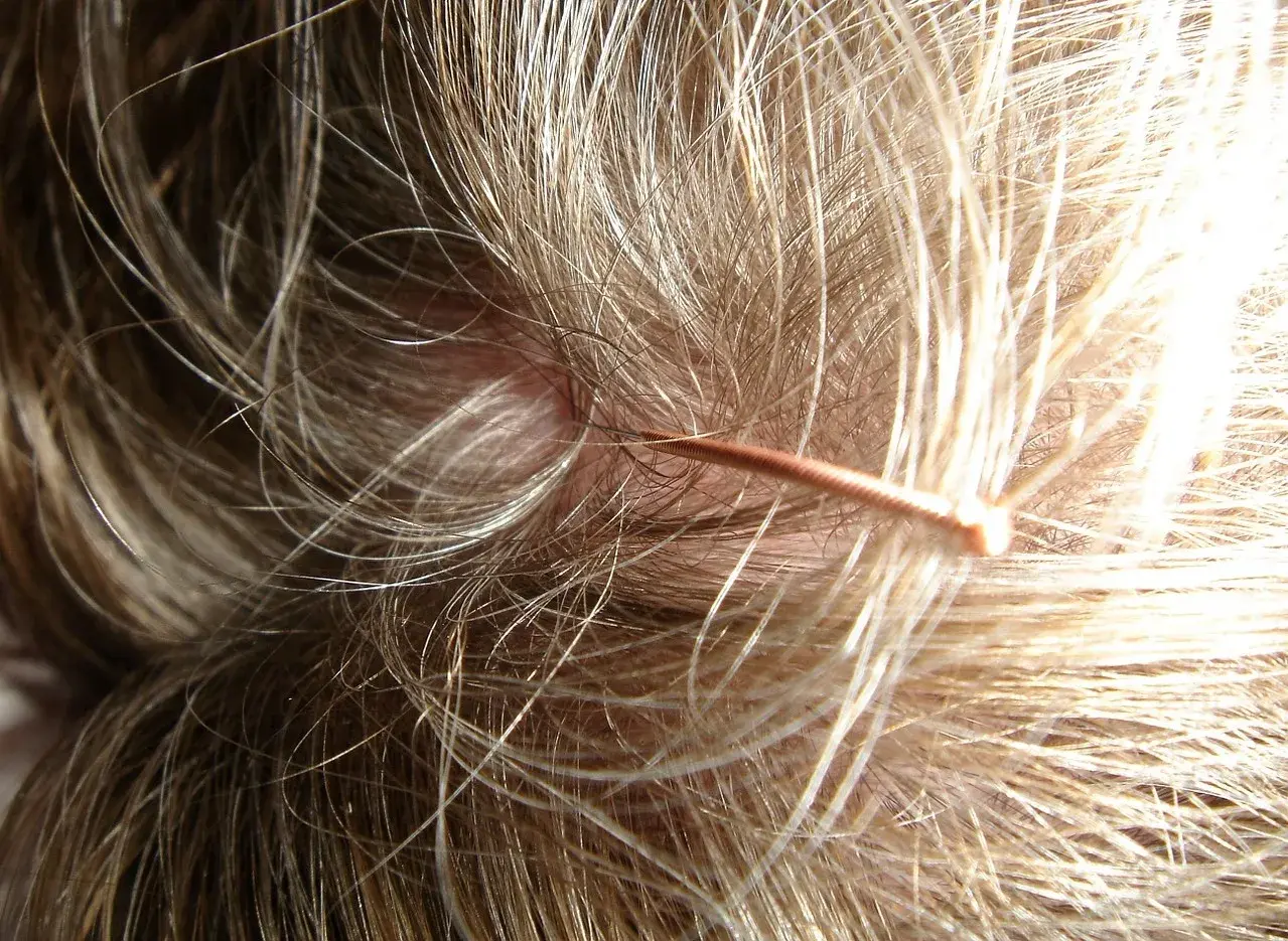 Nahaufnahme einer juckenden Kopfhaut mit feinen Haaren. Ein dünner, kupferfarbener Gegenstand, vielleicht ein Werkzeug für juckende Kopfhaut Hausmittel, liegt auf den Haaren.