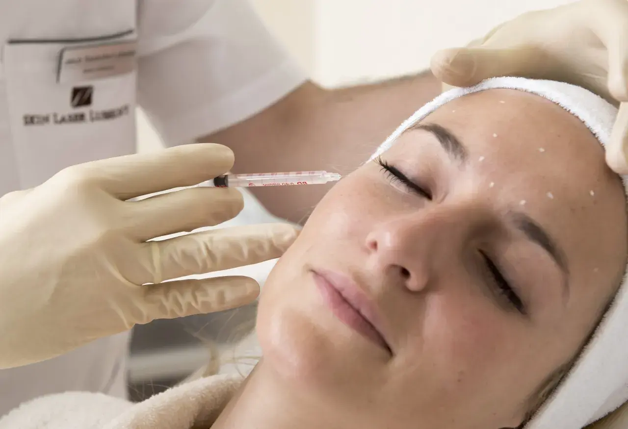 Zabieg z użyciem botoksu: precyzyjne botox miejsca wstrzyknięć na czole i skroniach.