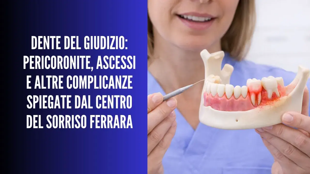 Modello di mascella con dente del giudizio infiammato, che illustra il dolore alla pressione. Dentista spiega complicazioni.
