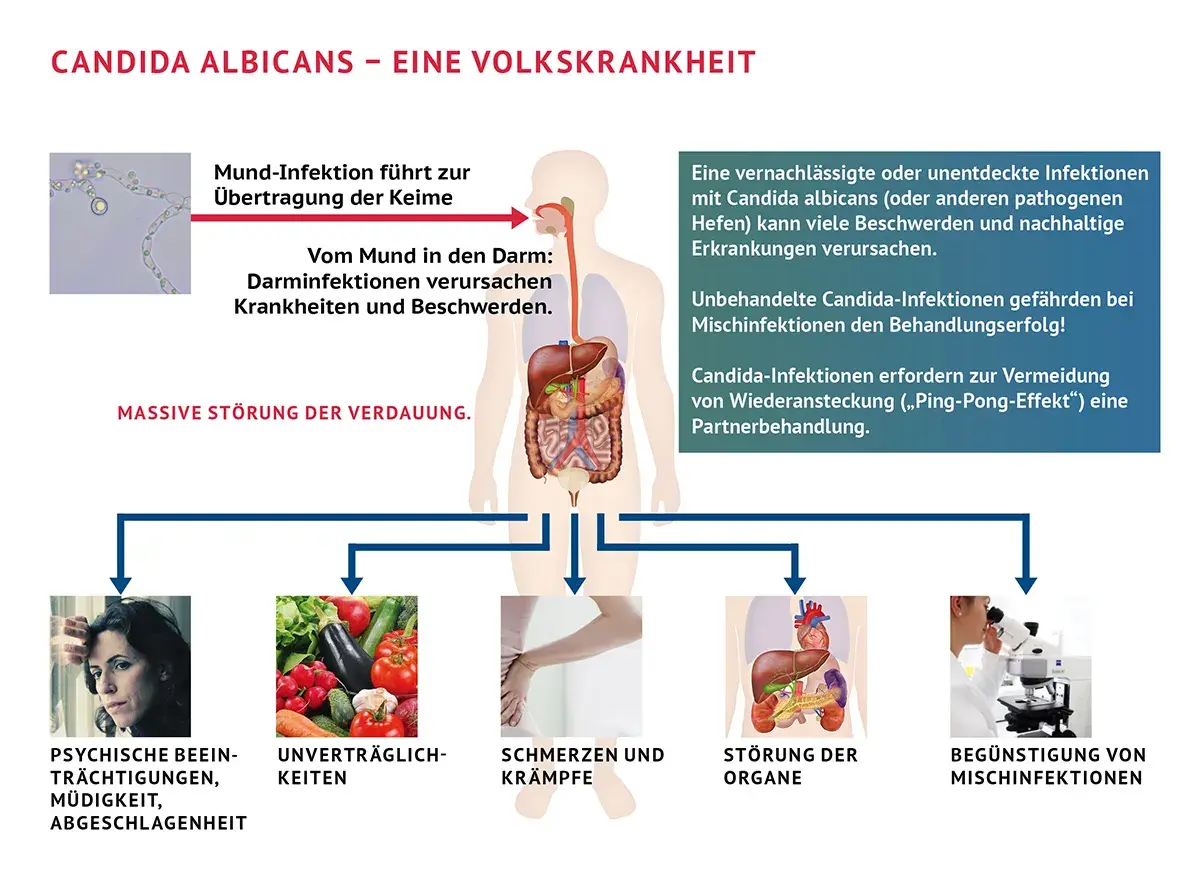 Psychische Belastung, Verdauungsprobleme, Schmerzen, Organstörungen und Mischinfektionen sind Symptome, wenn Candida abstirbt.