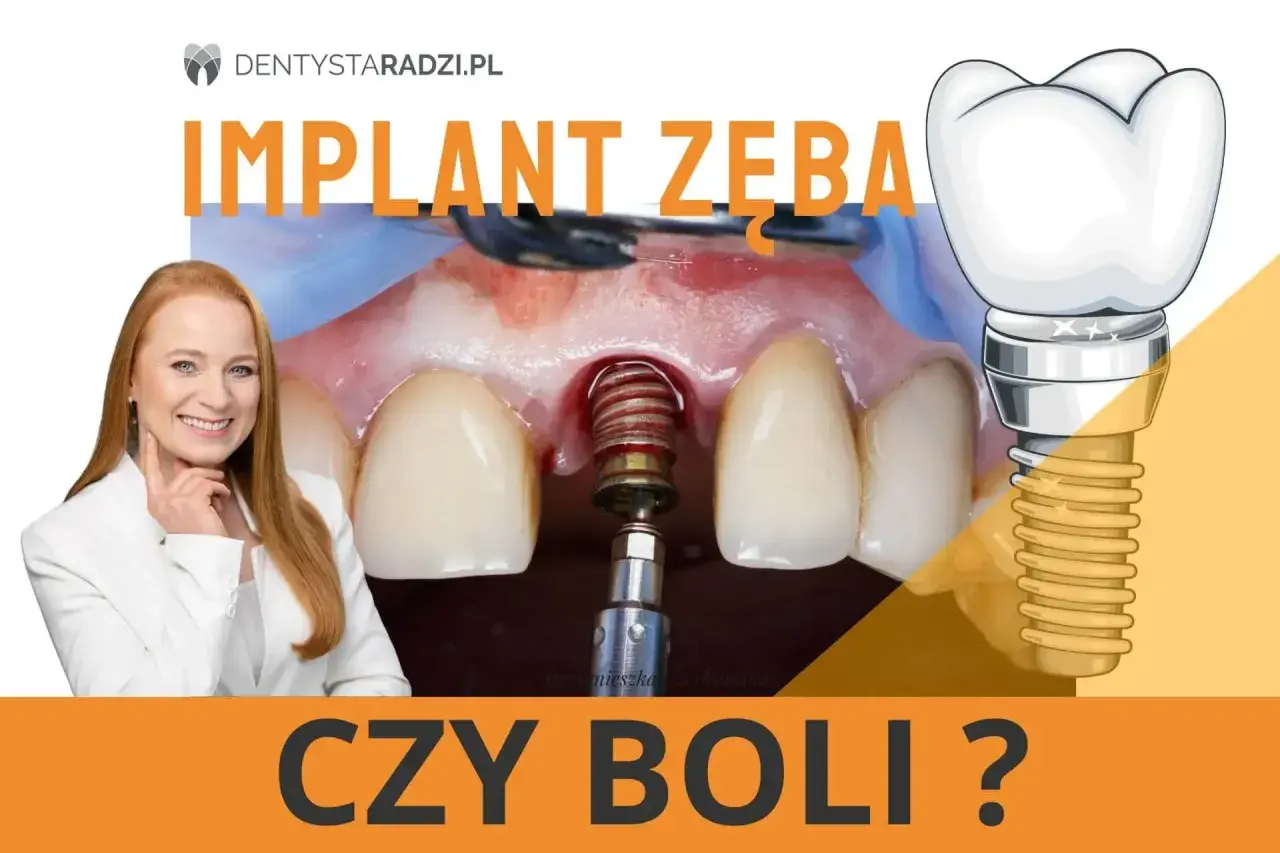 Implant zęba czy boli? Uśmiechnięta dentystka i zbliżenie na implant w trakcie zabiegu.