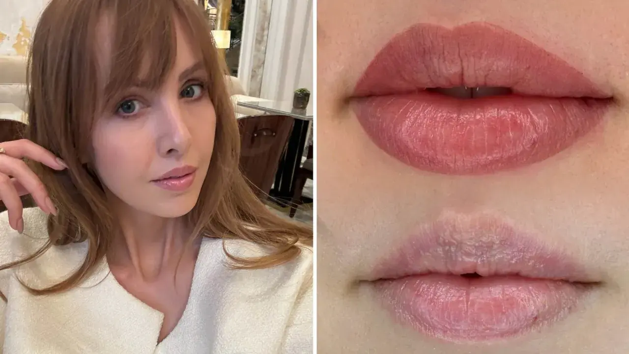 Kvinna med ljus hy och brunt hår. Närbild på läppar före och efter lip blush-behandling.