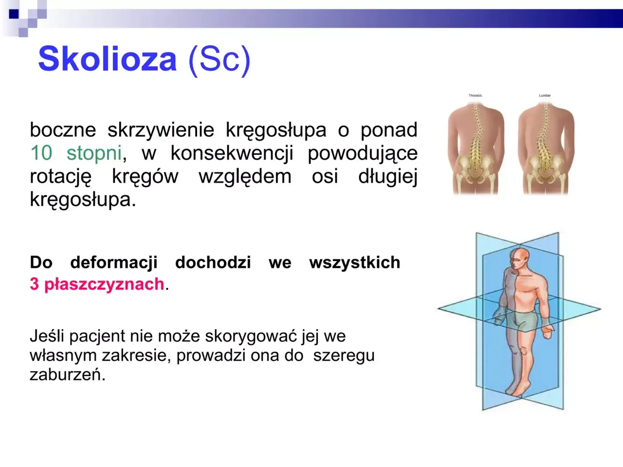 Skolioza (Sc) to boczne skrzywienie kręgosłupa. Test rissera ocenia dojrzałość kostną, pomocną w prognozowaniu progresji skoliozy.