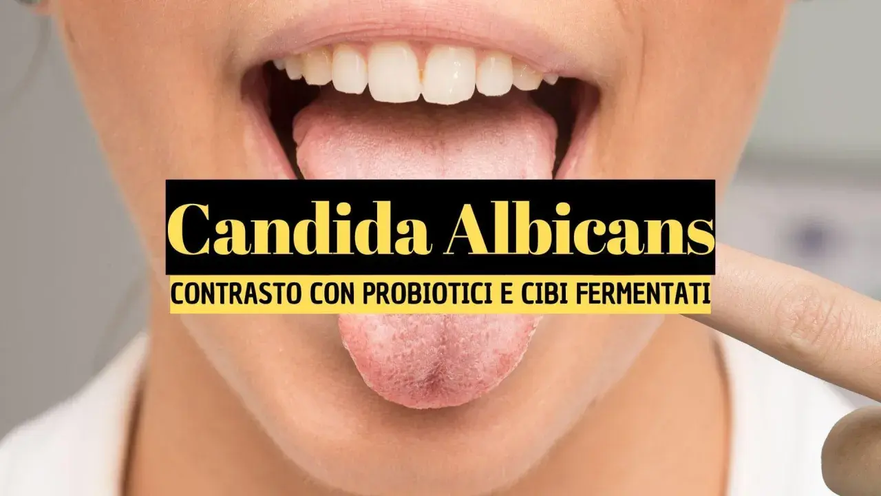 Lingua con candida orale. Contrasto con probiotici e cibi fermentati per combattere la candidosi.