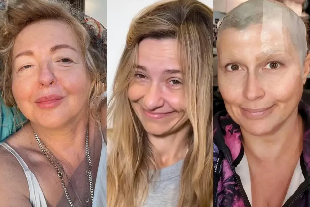 Trzy kobiety w uśmiechu, każda w swoim stylu. Jedna z nich, po chemioterapii, pokazuje siłę. To piękno bez makijażu.