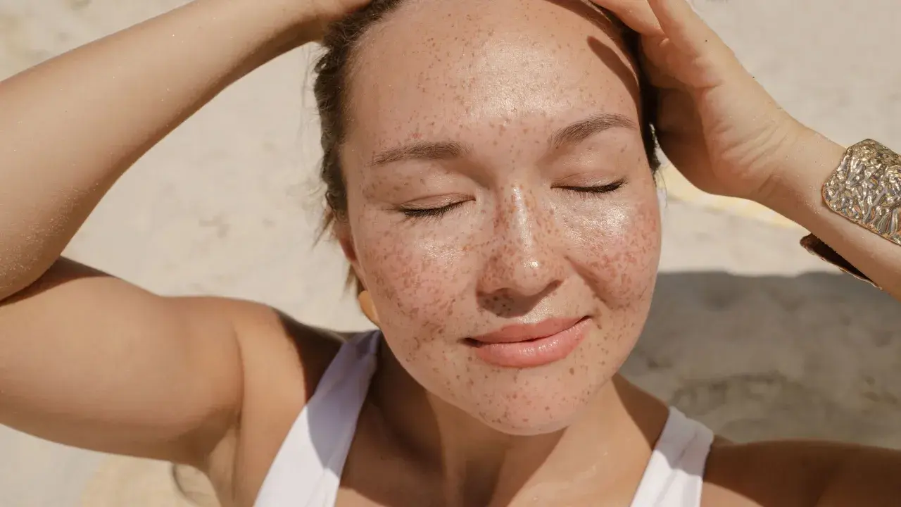 Donna con lentiggini al sole, con le mani tra i capelli. Forse la crema solare tutti i giorni fa male?