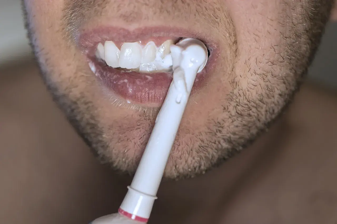 Bocca con denti bianchi e spazzolino elettrico. Nonostante la cura, la carie è una preoccupazione.