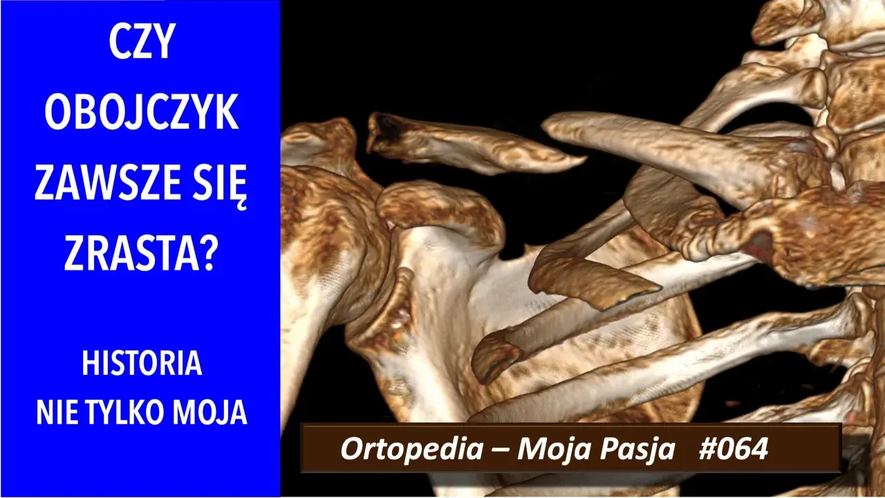 Trójwymiarowy obraz obojczyka, który pokazuje, ile zrasta się kość po urazie. "Ortopedia – Moja Pasja #064".