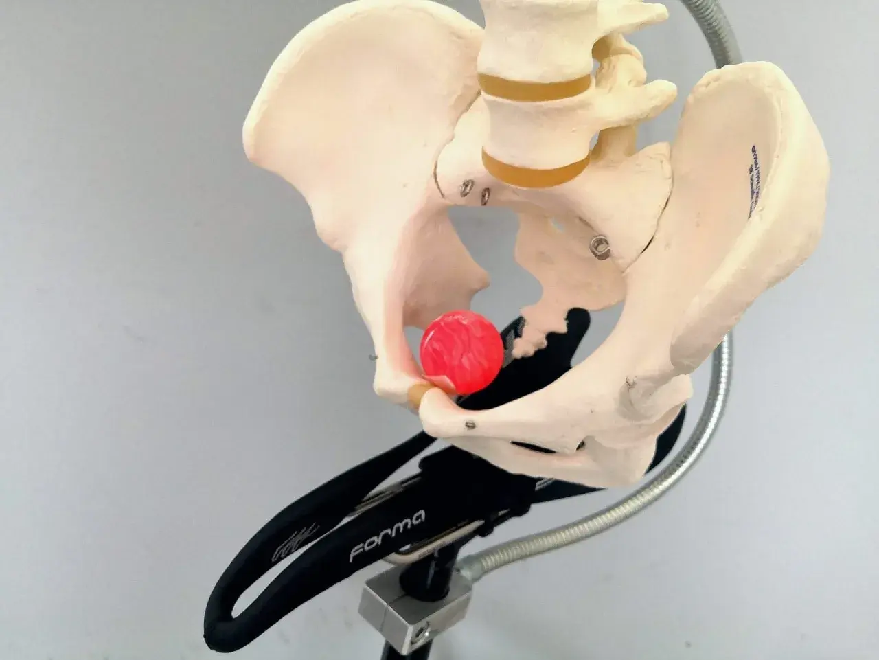 Modello anatomico del bacino su un supporto, con una sfera rossa posizionata per illustrare il dolore sellino bici.
