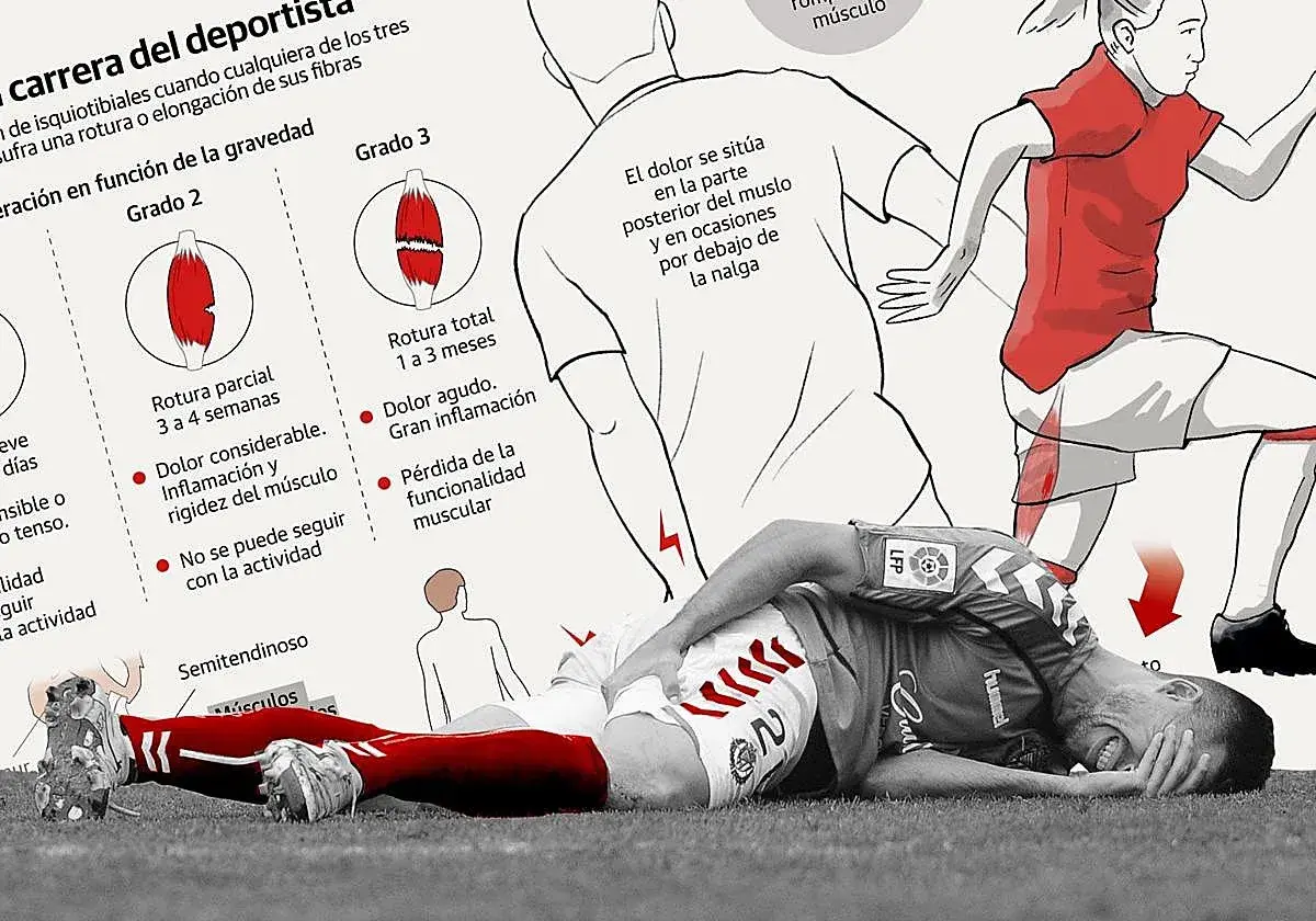 Ilustración sobre lesiones de isquiotibiales, mostrando grados de rotura y un deportista con dolor.