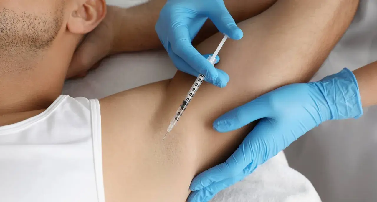 En person får botox mot svett i armhålan. En spruta injicerar vätska under huden.