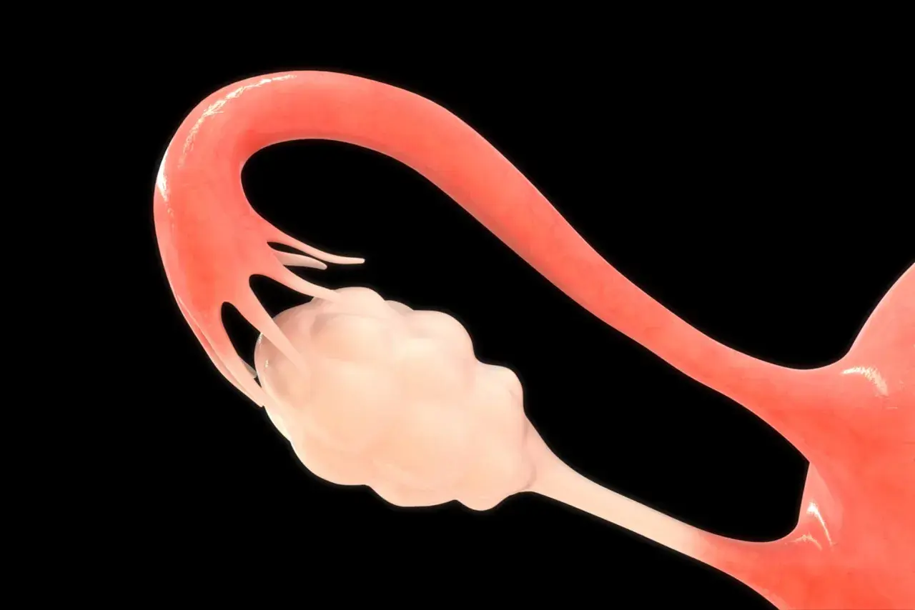 Anatomia kobieca: jajniki i jajowód. Jasnoróżowy jajnik otoczony strzępkami jajowodu.