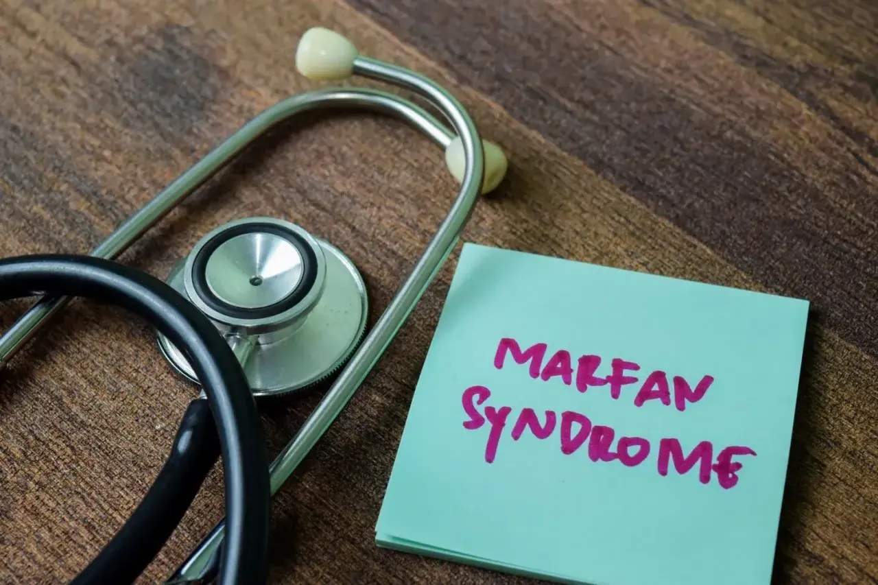 Stetoskop obok notatki z napisem "Marfan Syndrome". Informacja o chorobie, która może dotyczyć wielu układów.