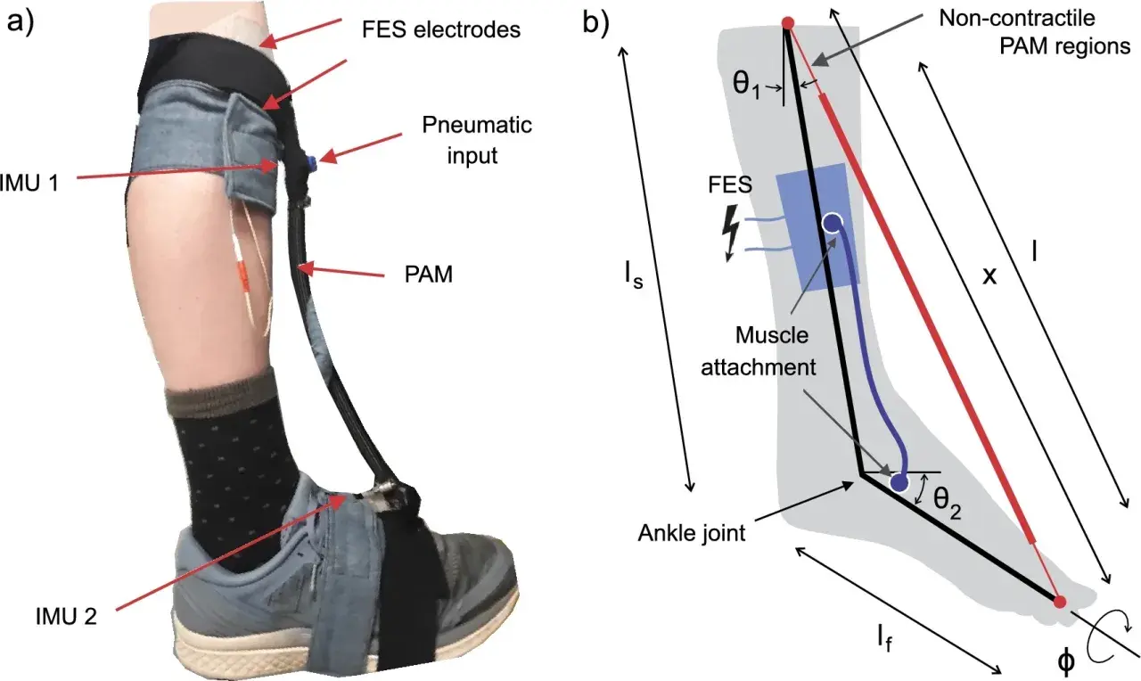 Sistema di elettrostimolazione per piede cadente con sensori IMU e attuatore PAM.