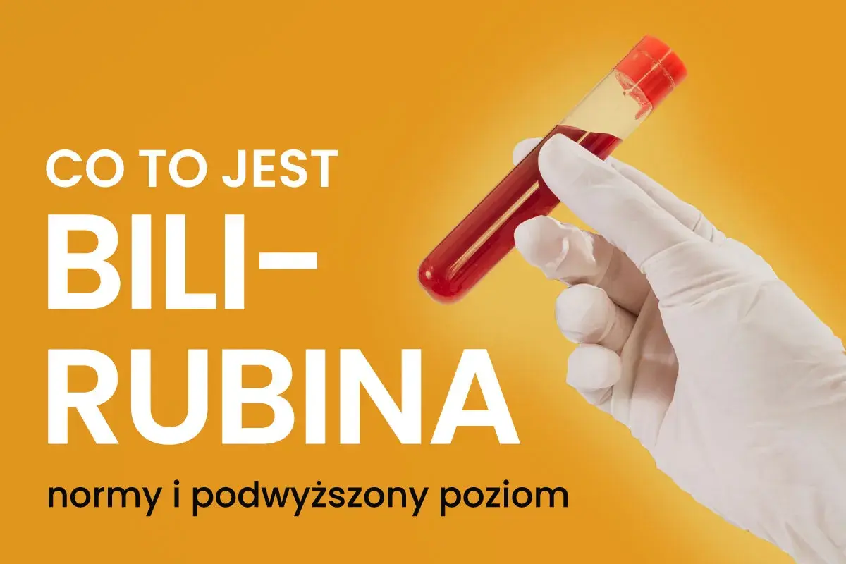 Co to jest bilirubina? Normy i podwyższony poziom. Ręka w rękawiczce trzyma probówkę z krwią.