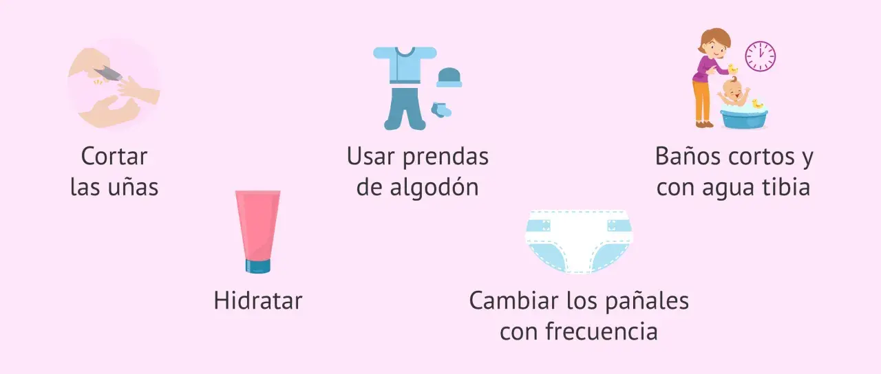 Consejos para el cuidado de la piel atópica en niños: cortar uñas, hidratar, usar algodón, baños tibios y cambiar pañales.