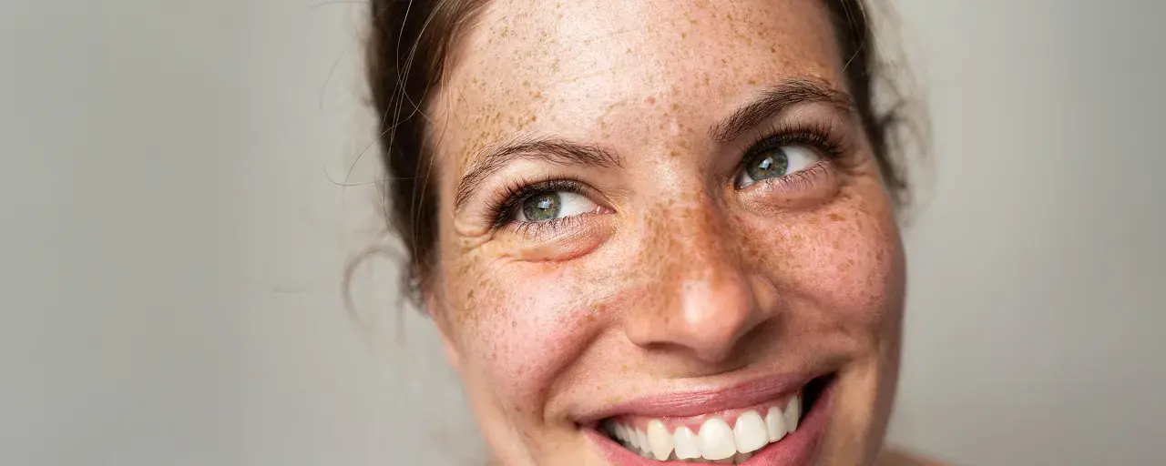 Lachendes Gesicht einer Frau mit Sommersprossen, die den natürlichen Pigment-Haut-Look unterstreichen.