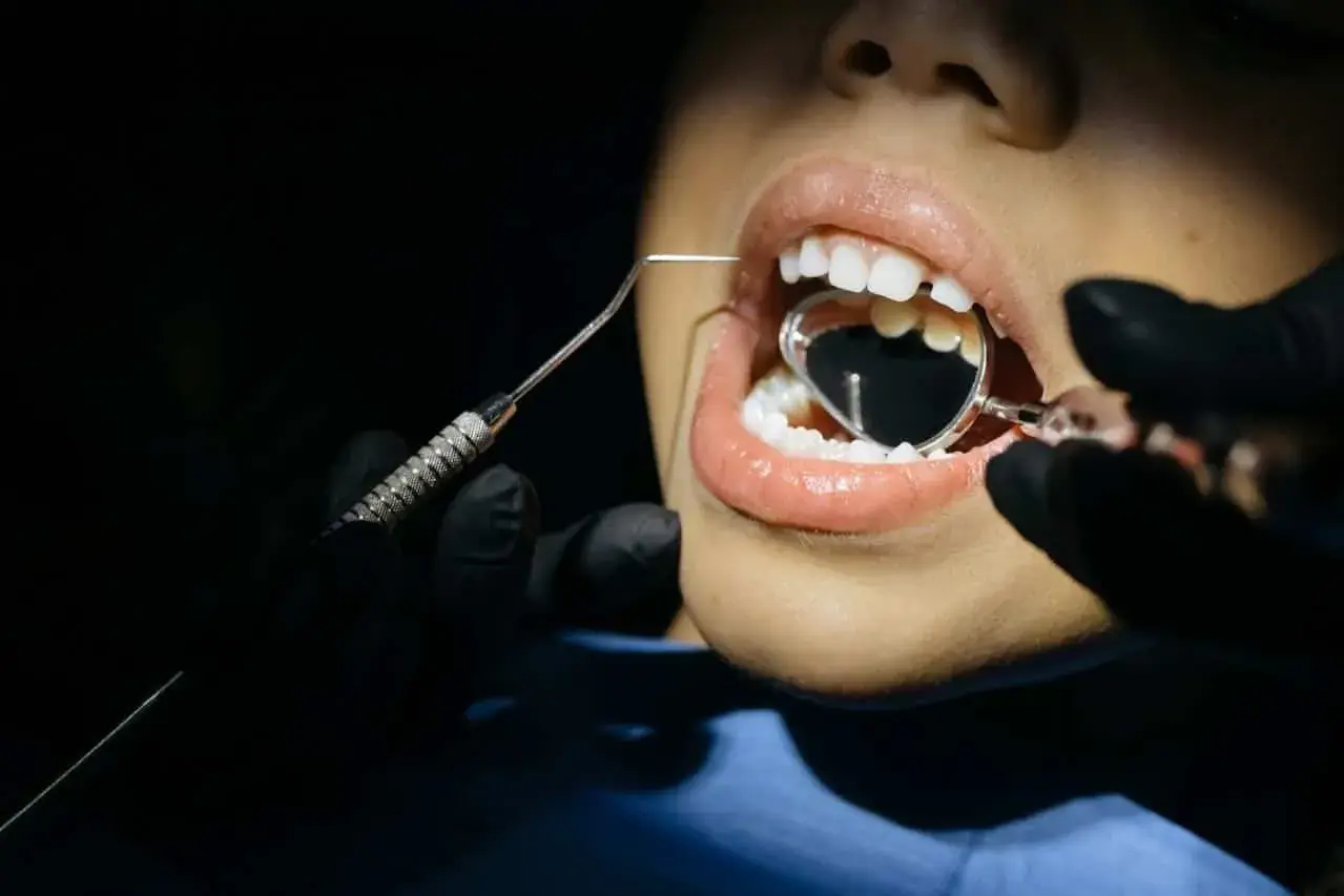 Boca abierta con espejo dental y explorador. ¿Se me rompen las muelas? Significa que es hora de visitar al dentista.