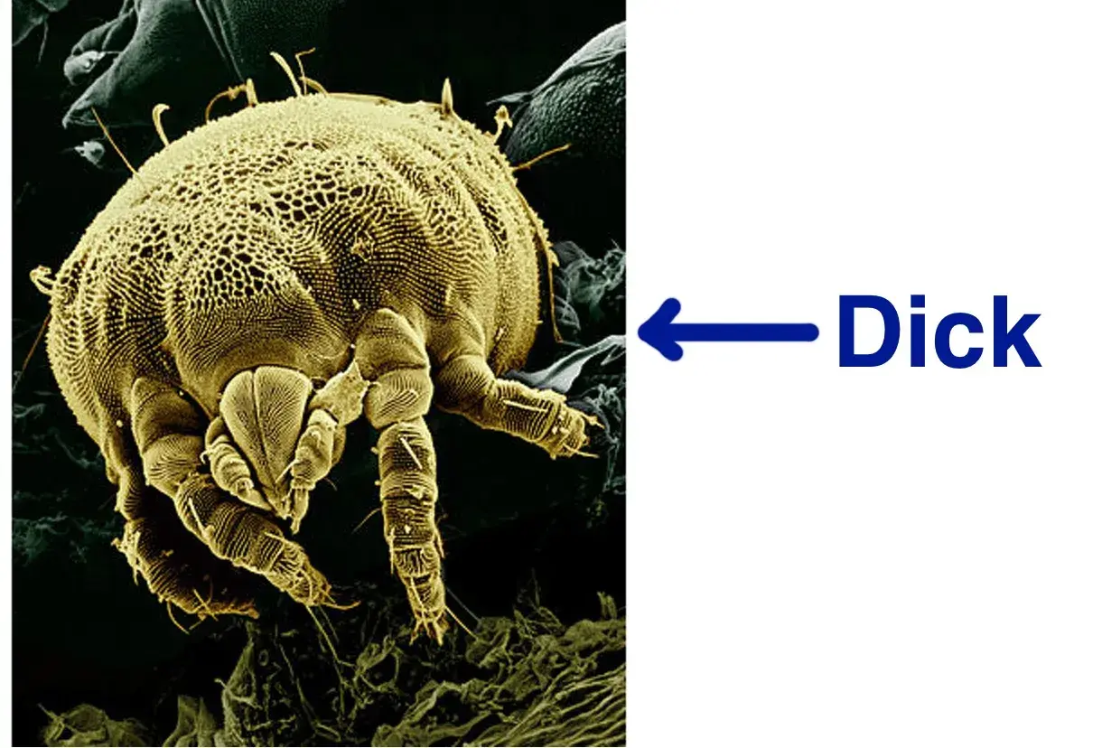Microscopic view of a dust mite, a common allergen found in mattresses.
