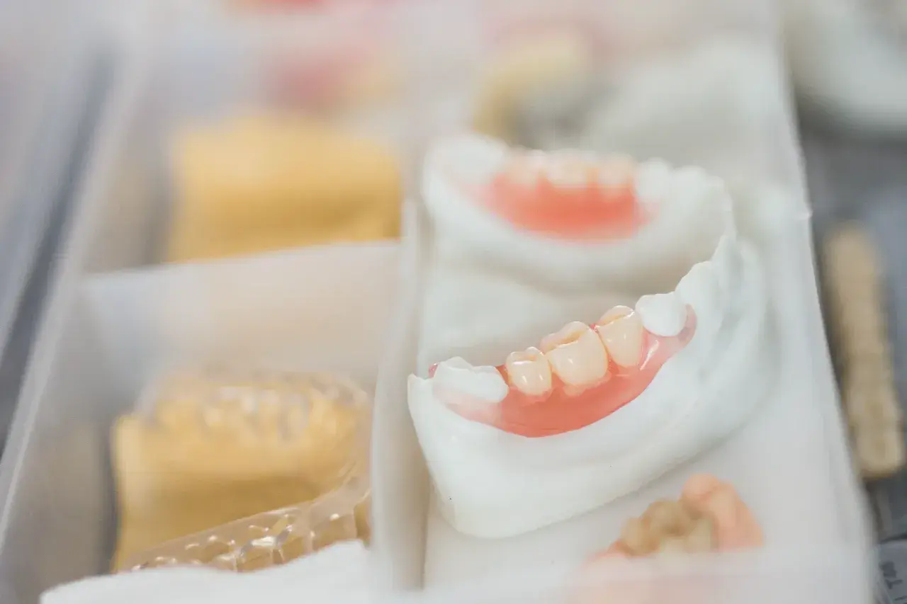 Protesi mobile inferiore in fase di lavorazione. Si osservano i denti artificiali e la base rosa, pronti per risolvere i problemi di masticazione.