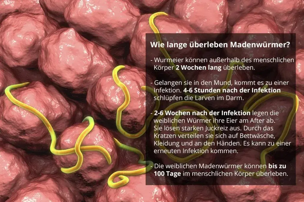 Madenwürmer Symptome: So erkennen Sie die Anzeichen rechtzeitig