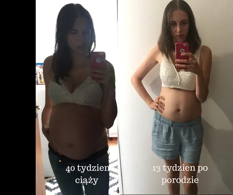 Czy biodra po porodzie się zejdą? Jak wrócić do formy i uniknąć zmian