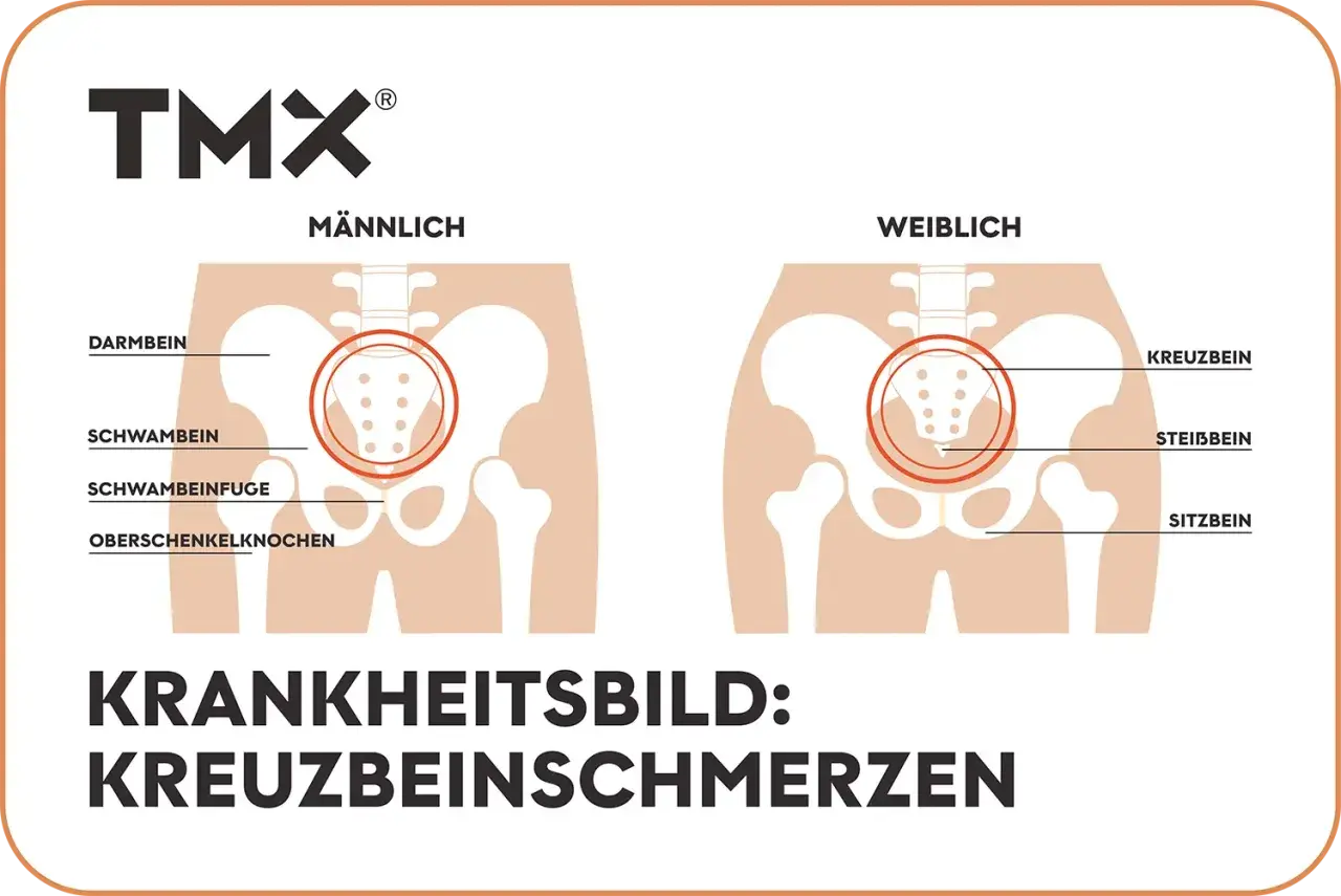 Vergleich männliches und weibliches Becken mit Hervorhebung des os sacrum. Illustration von Kreuzbeinschmerzen.