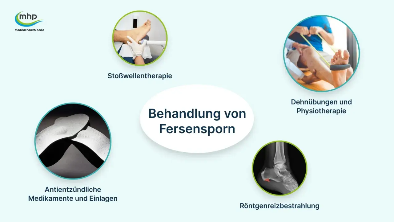 Behandlung von Fersensporn: Stoßwellentherapie, Dehnübungen, Medikamente, Einlagen und Röntgenreizbestrahlung.