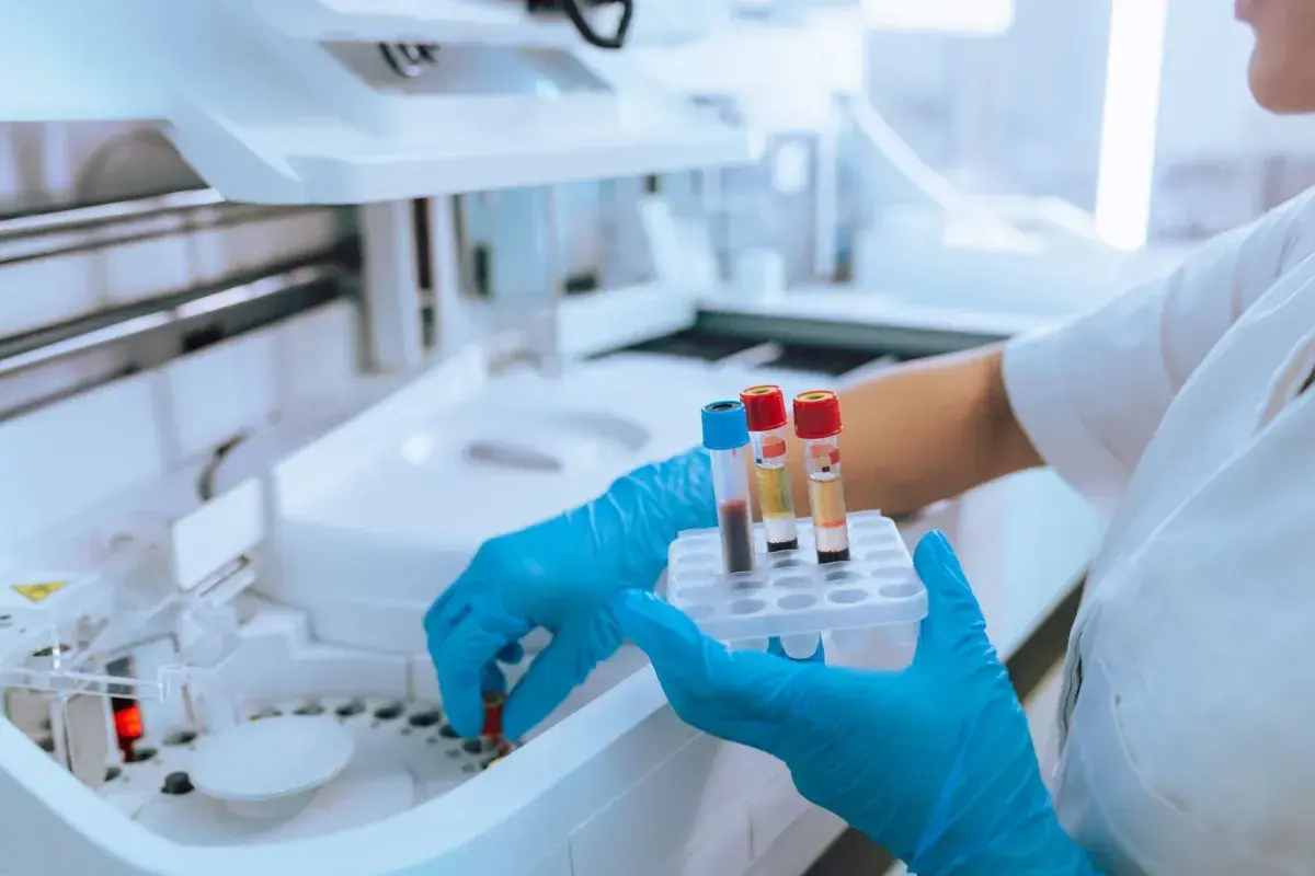 Ręce w niebieskich rękawiczkach trzymają probówki z krwią przy aparaturze laboratoryjnej.