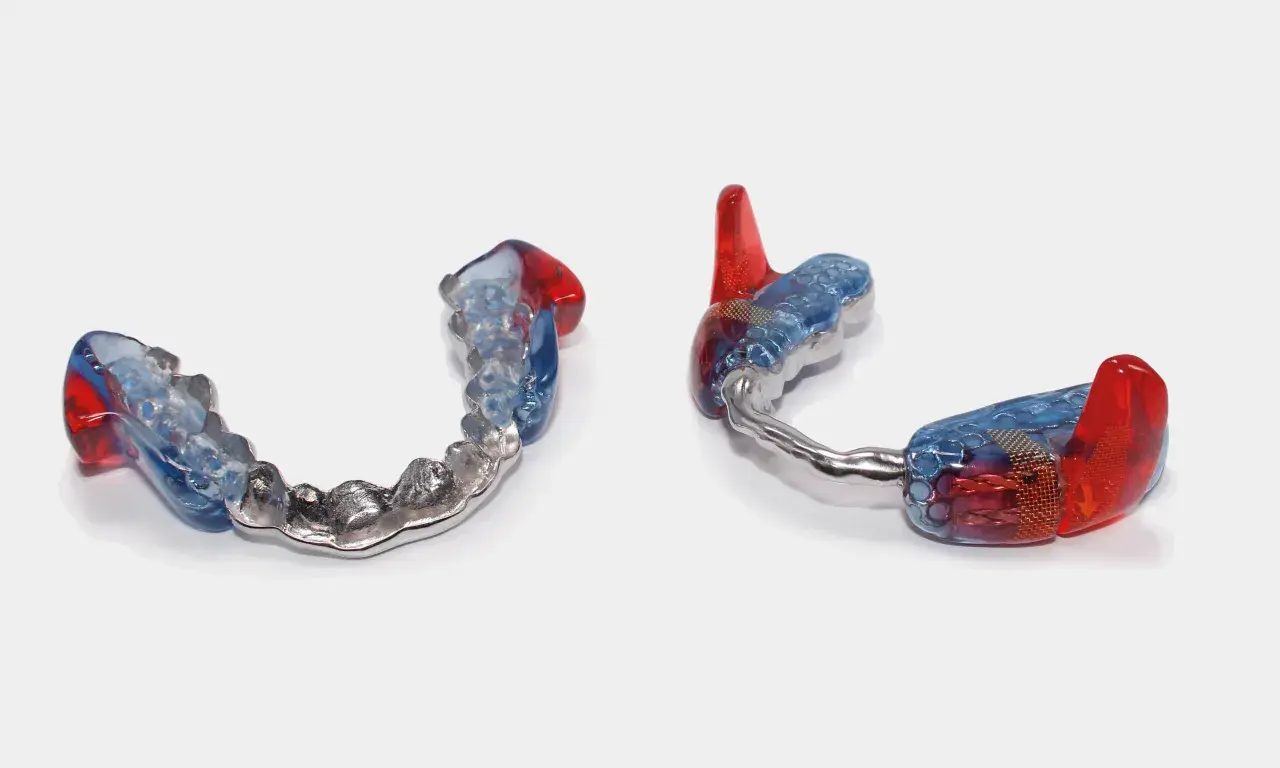 Dos aparatos mandibulares transparentes con detalles en rojo y azul, uno con una banda metálica.