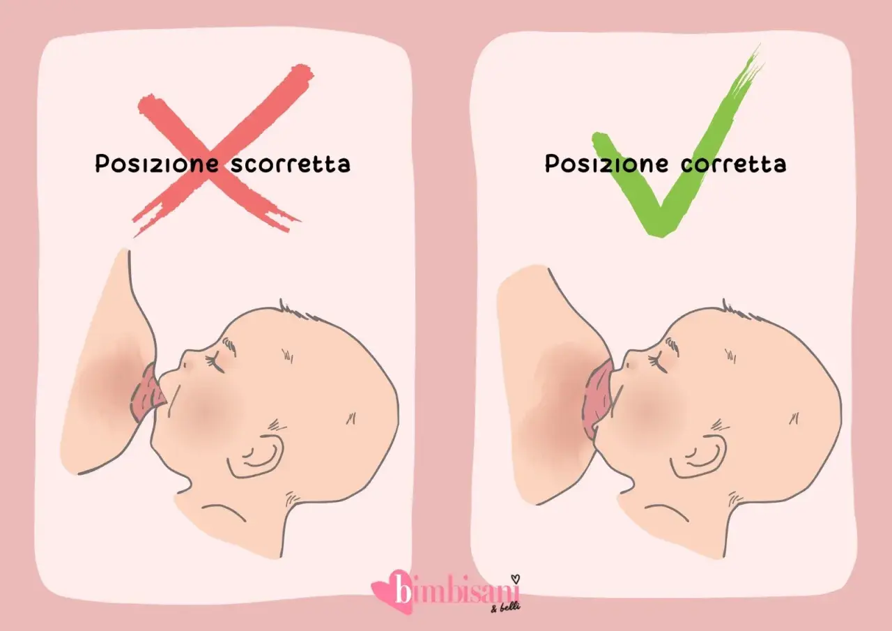 Posizione scorretta vs corretta per allattare, per evitare ragadi al seno.