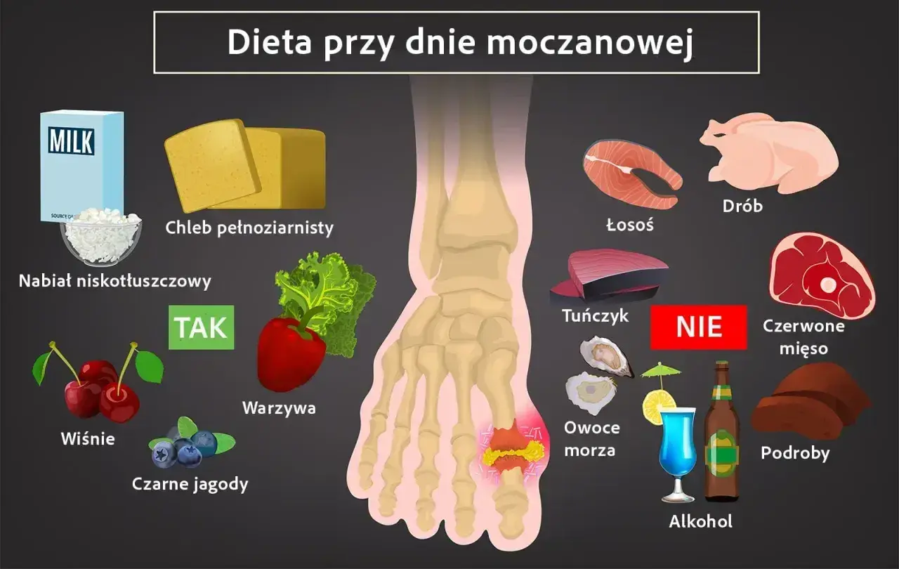 Dieta przy dnie moczanowej: TAK - nabiał, chleb, warzywa, owoce. NIE - drób, ryby, czerwone mięso, podroby, alkohol.