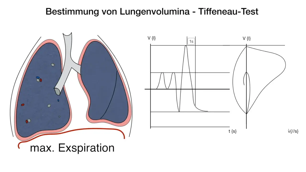 Lungenvolumenbestimmung mittels Tiffeneau-Index: Lunge, Fluss-Volumen-Kurve und Zeit-Volumen-Diagramm.