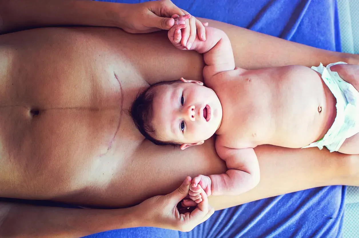 Neugeborenes Baby auf dem Bauch der Mutter, die eine Kaiserschnittnarbe hat. Sanfte Berührung und Heilung durch Osteopathie nach Kaiserschnitt.