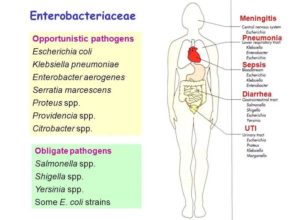 Bacterium lactis aerogenes: 5 kluczowych faktów dla zdrowia