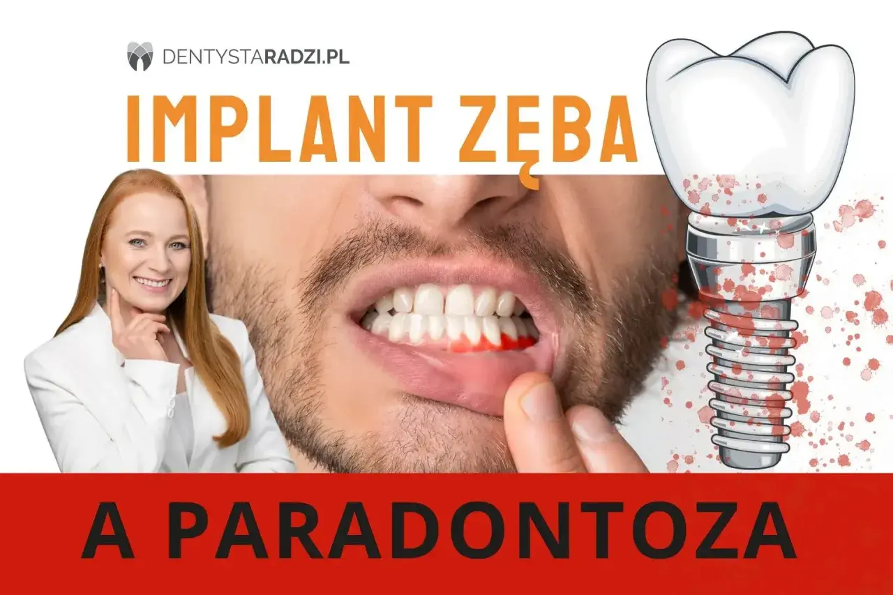 Implant zęba a paradontoza. Krwawiące dziąsła i implant zębowy z plamami krwi. Dentystka radzi.