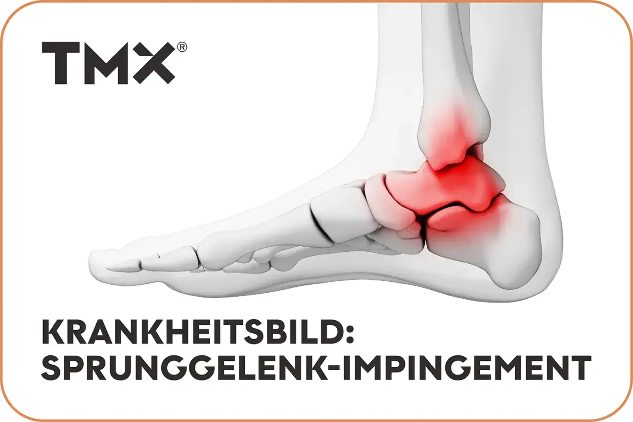 3D-Darstellung eines Fußes mit rot markiertem Sprunggelenk.