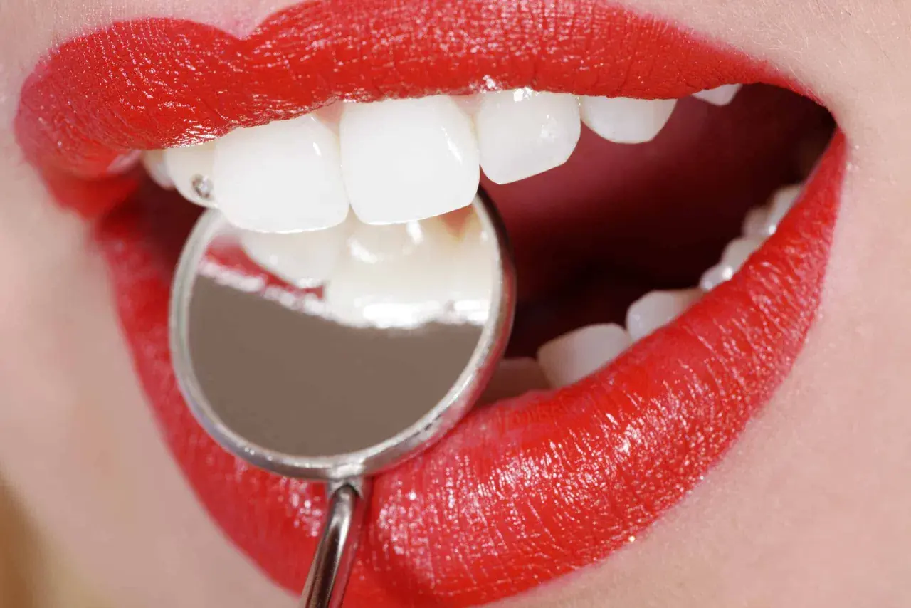 Labios rojos brillantes y dientes blancos examinados con un espejo dental. Averiguar cuanto se tarda en hacer un empaste pequeño es rápido.