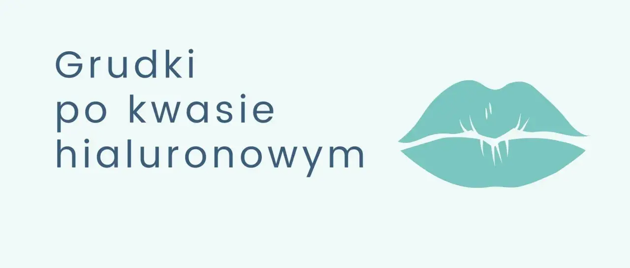 Grudki po kwasie hialuronowym mogą być niepokojące, ale często znikają samoistnie. Stylizowana grafika ust podkreśla temat.