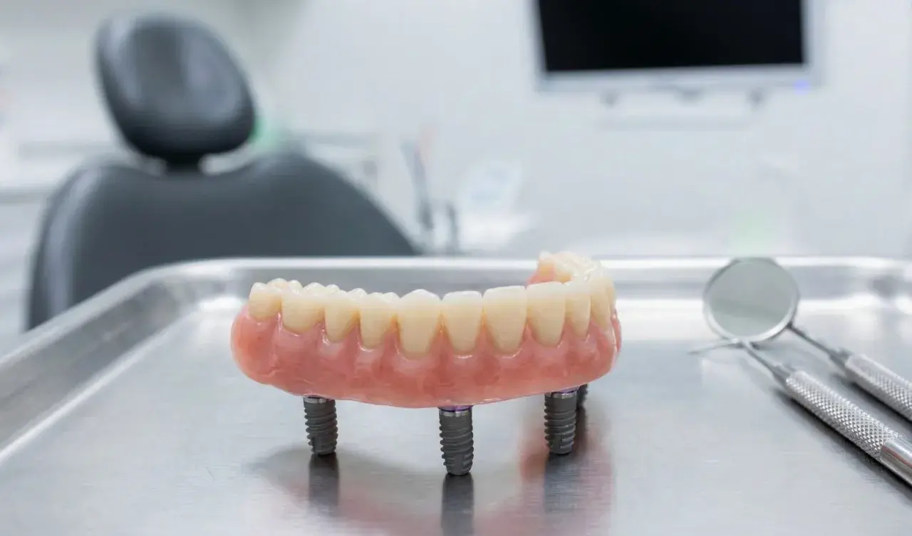 Proteza na implantach, gotowa do montażu. Nowoczesne rozwiązanie dla pełnego uśmiechu.