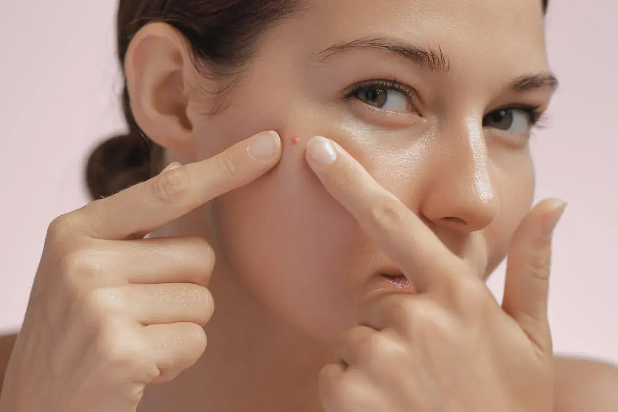 Une jeune femme examine un bouton sur sa joue, un signe possible pour savoir si on a une peau grasse.
