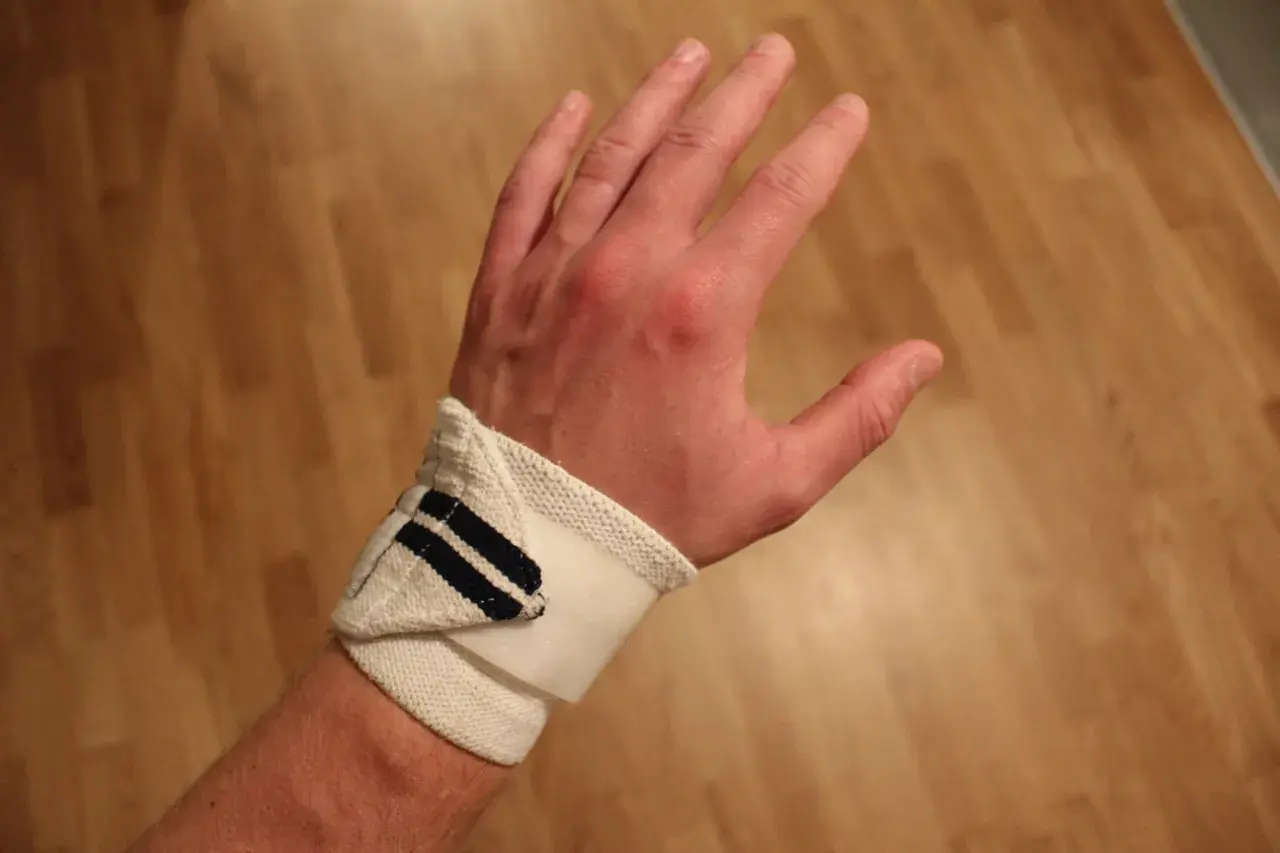En hand med handledsskydd, kanske för att stödja en svag handled. Skyddet är vitt med mörkblå ränder.