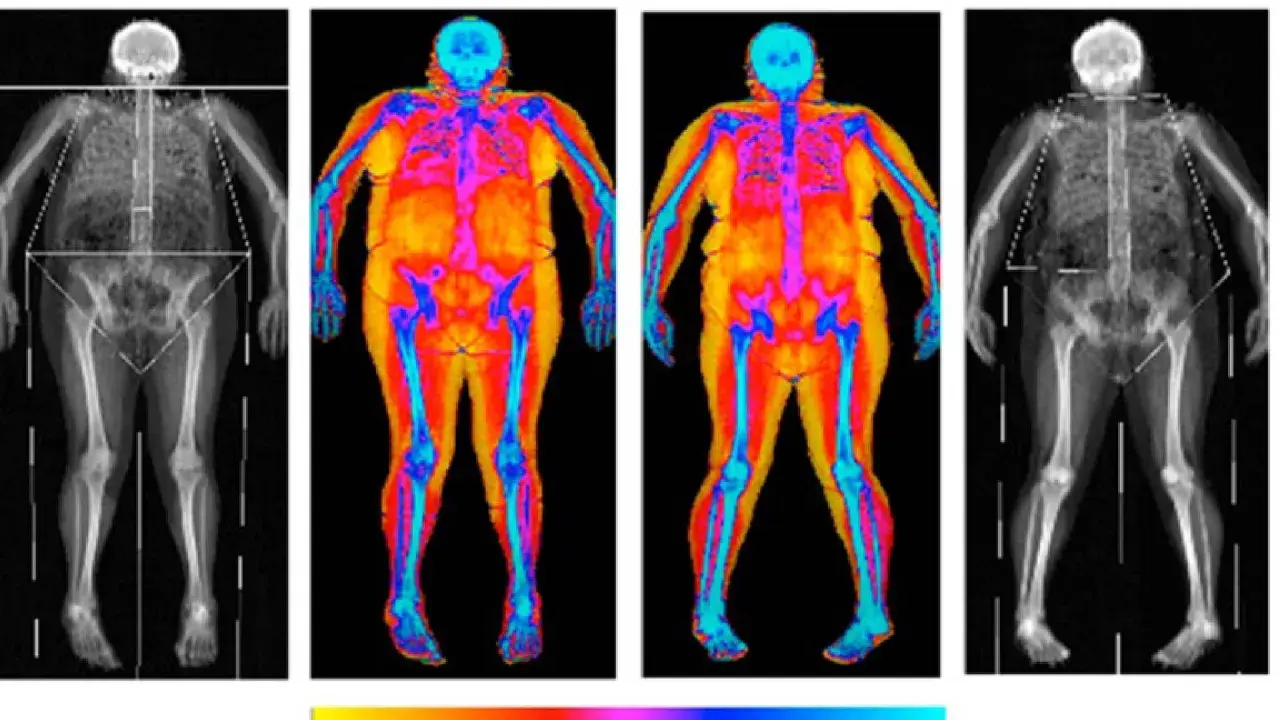 Radiographies et thermographies corporelles montrant une transformation : je m'affine mais je prends du poids. Les couleurs chaudes indiquent la graisse, les bleues les os.