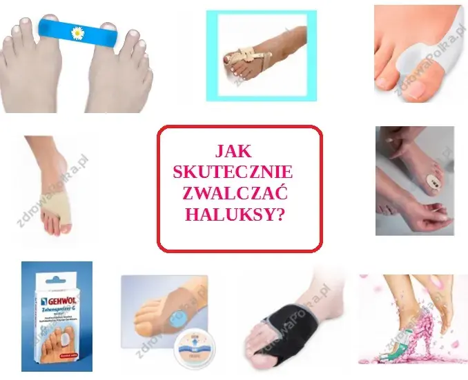 Skuteczna profilaktyka haluksów: Twój przewodnik do zdrowych stóp