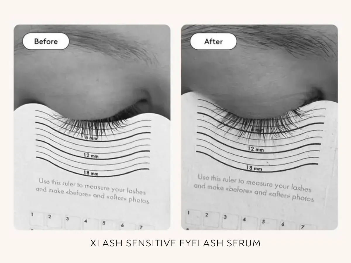 Före- och efterbilder som visar hur fransarna växer med Xlash prostaglandin. Mätning visar tydlig längdökning.