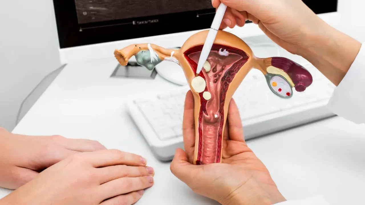 Model narządu rodnego kobiety z zaznaczonymi zmianami, które mogą wskazywać na raka endometrium. Lekarz wyjaśnia pacjentce.